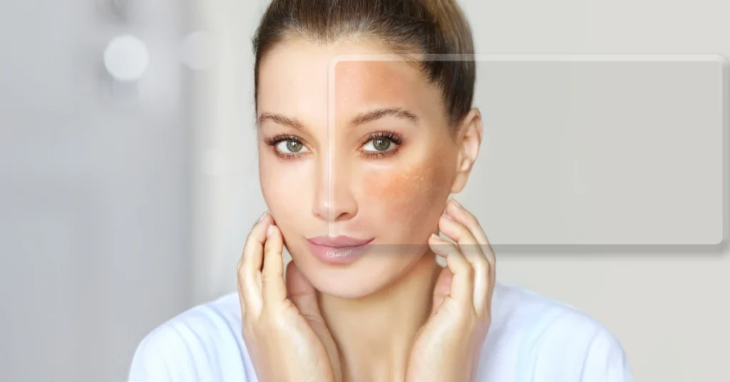 causes of dull skin