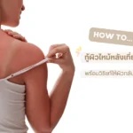 how to treat beach sunburn